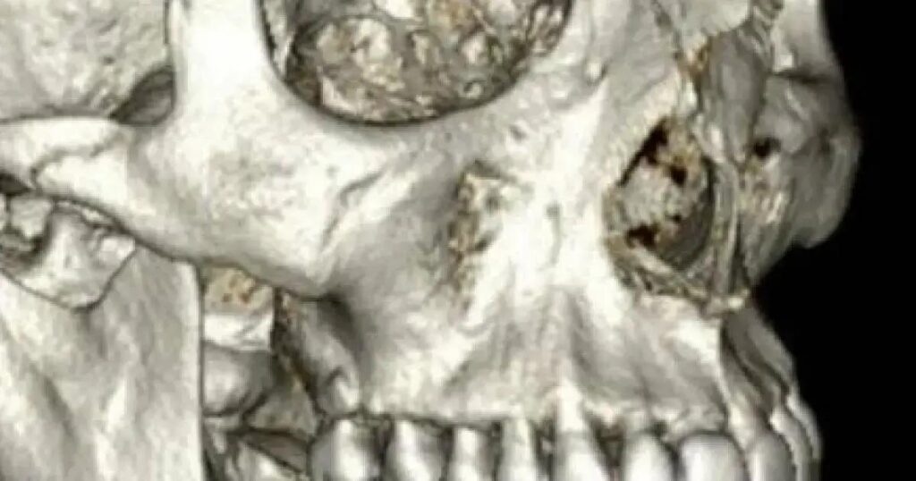 Ator Henri Castelli é indenizado em R$ 55 mil após agressão