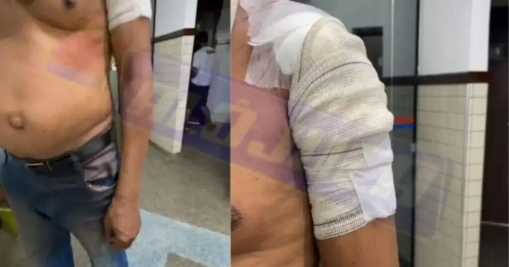 Homem é baleado durante assalto em Vila de Abrantes