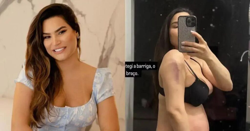 Ex-participante de A Fazenda é hospitalizada após queda durante gravidez