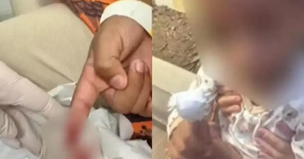 Menino sofre ataque de piranhas em lago na zona rural de Jequié