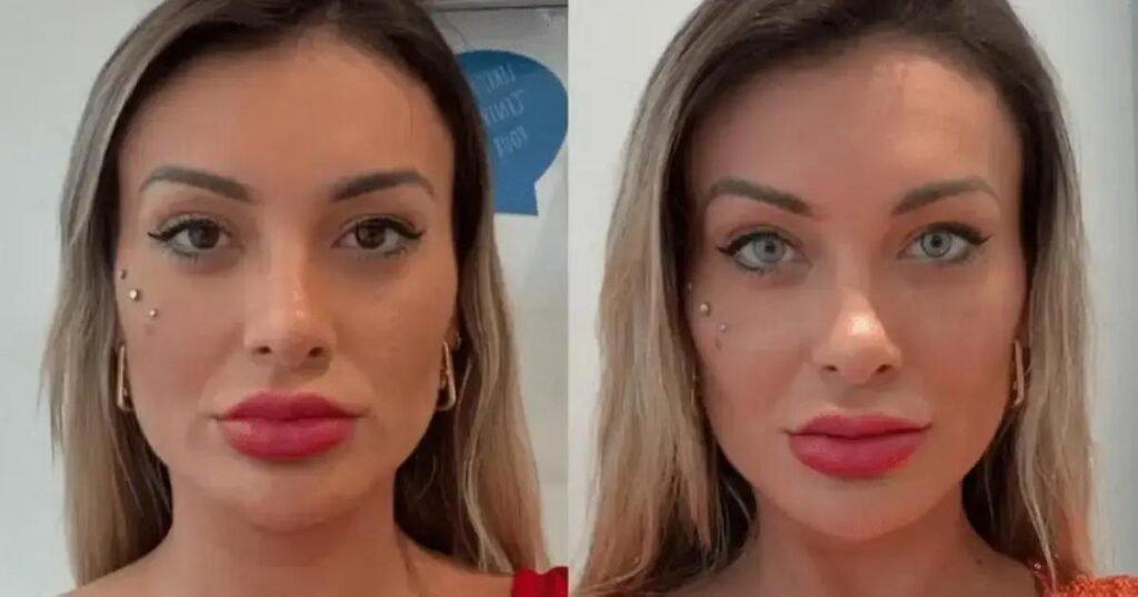 Andressa Urach revela arrependimento por cirurgia nos olhos