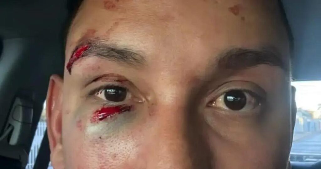 Médico é agredido em camarote durante festa junina em Irecê