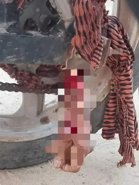 Mulher perde a mão em acidente com motocicleta no distrito de Ribeirão do Salto