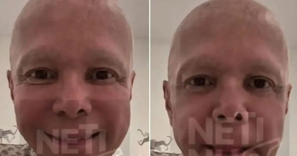 Netinho está na reta final do tratamento de câncer após anunciar cura