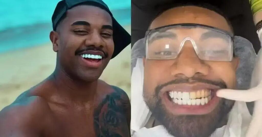 Davi Brito troca lentes e transforma sorriso após polêmica na web