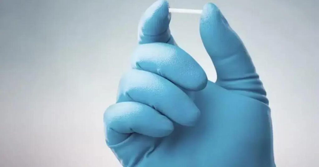 SUS oferece gratuitamente o implante contraceptivo hormonal Implanon