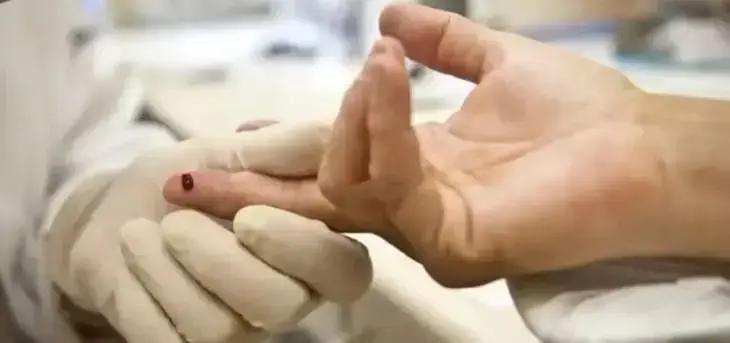 Sesab desmente surto de HIV entre adolescentes na Bahia com dados oficiais