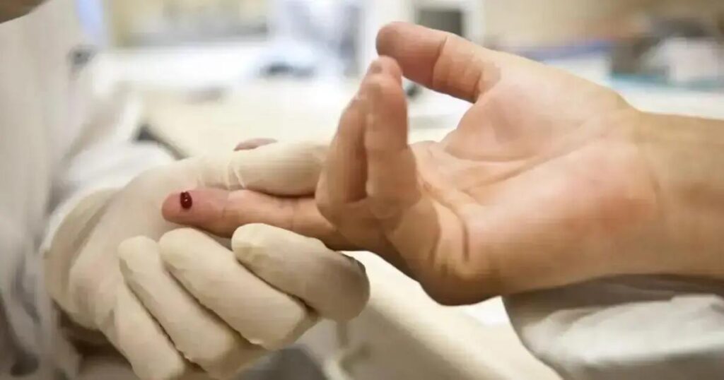 Sesab nega surto de HIV entre jovens na Bahia e esclarece dados