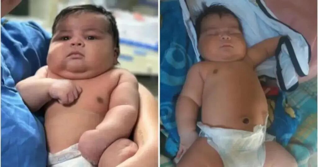 Bebê de 6,5kg nasce em parto normal com complicações no Espírito Santo
