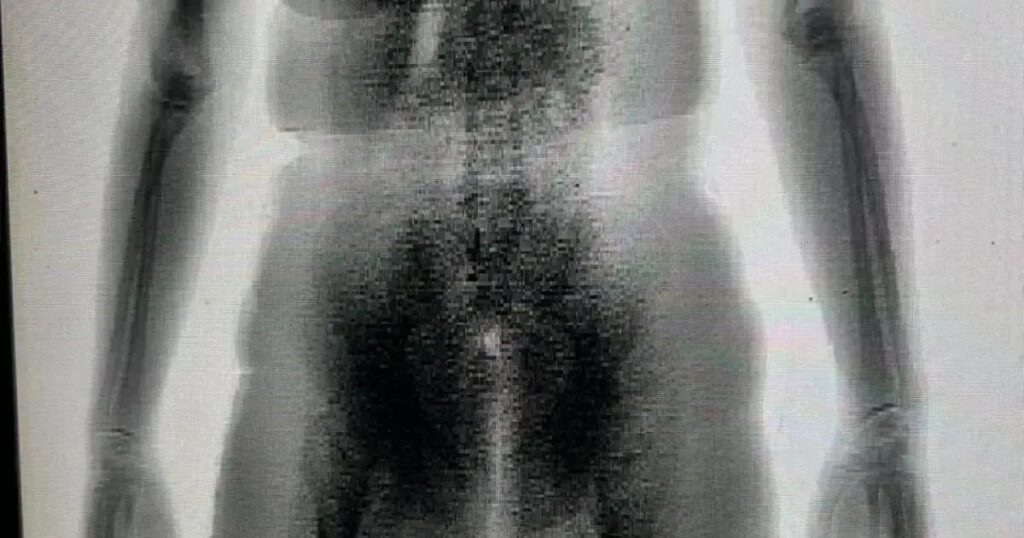 Mulher flagrada com drogas nas partes íntimas ao tentar entrar em presídio na Bahia