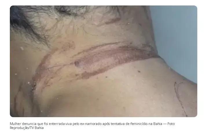 Mulher sobrevive após ser enterrada viva por ex-namorado em Itabuna