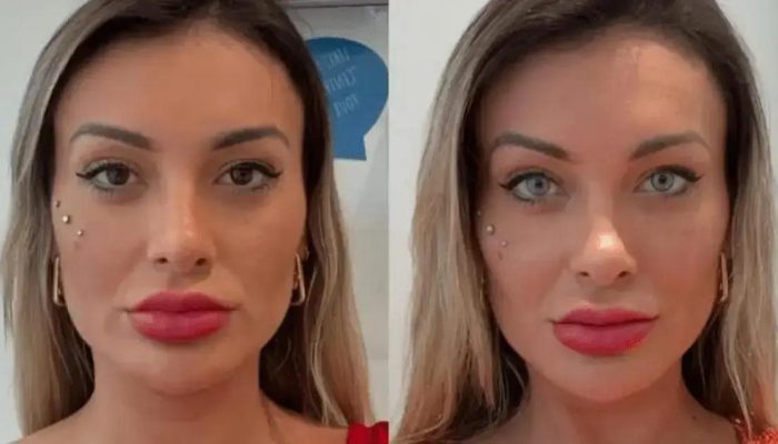 Andressa Urach revela arrependimento por cirurgia nos olhos