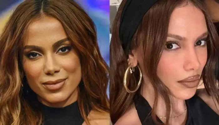 Anitta exibe novo rosto após infecção e afastamento das redes sociais