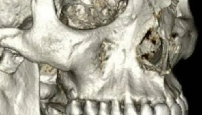 Ator Henri Castelli é indenizado em R$ 55 mil após agressão