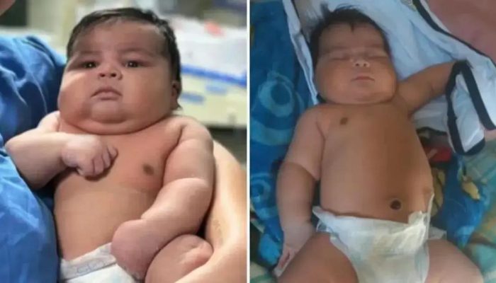 Bebê de 6,5kg nasce em parto normal com complicações no Espírito Santo