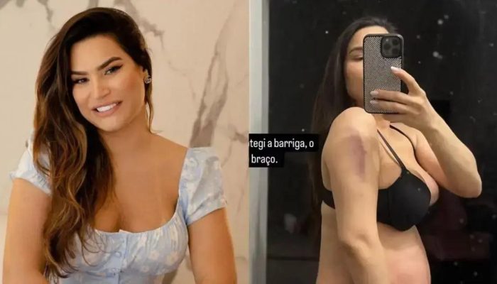 Ex-participante de A Fazenda é hospitalizada após queda durante gravidez