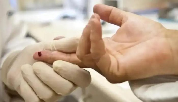 Governo dos EUA encerra pesquisa sobre vacina contra HIV e corta verbas