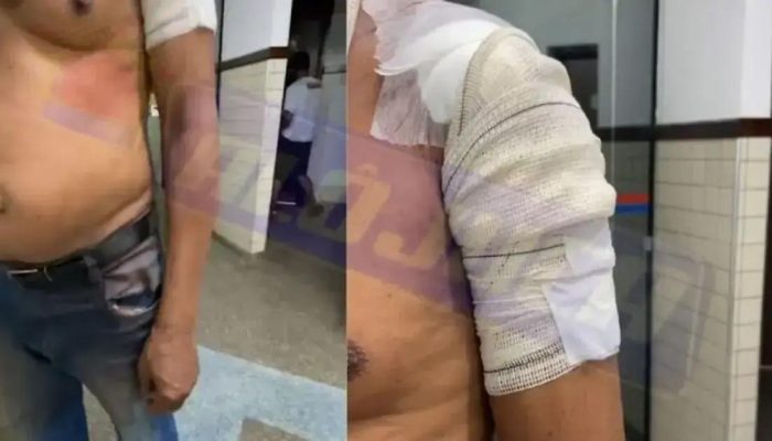 Homem é baleado durante assalto em Vila de Abrantes