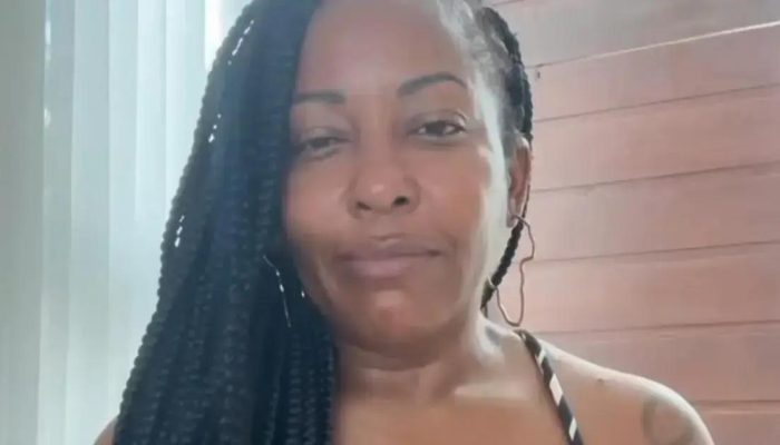 Maíra Azevedo revela cirurgia na boca e fala sobre recuperação divertida