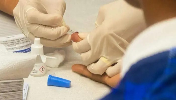 Mais de 10% dos testes para sífilis dão positivo em ação em Salvador