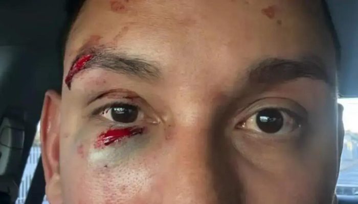 Médico é agredido em camarote durante festa junina em Irecê