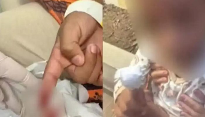 Menino sofre ataque de piranhas em lago na zona rural de Jequié