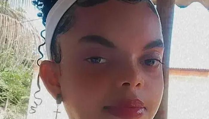 Milena Cabral, 17 anos, luta contra tumor cerebral e precisa de cirurgia urgente