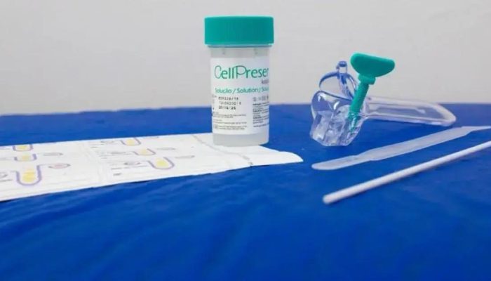 Ministério da Saúde implementa nova tecnologia para detectar câncer de colo do útero