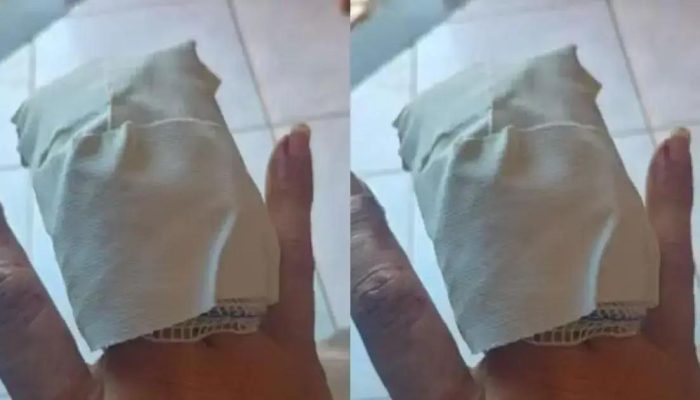 Motorista de aplicativo perde parte do dedo após explosão em Porto Seguro