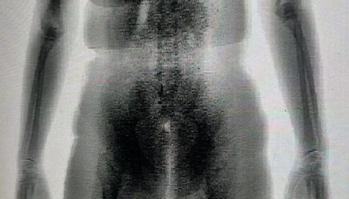 Mulher flagrada com drogas nas partes íntimas ao tentar entrar em presídio na Bahia