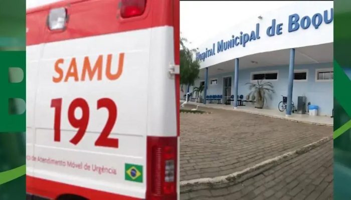 Mulher gravemente ferida após ataque de cães em Boquira, Bahia