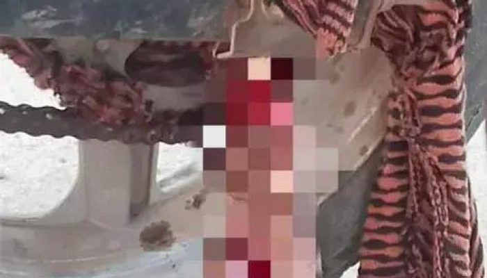 Mulher perde a mão em acidente com motocicleta no distrito de Ribeirão do Salto