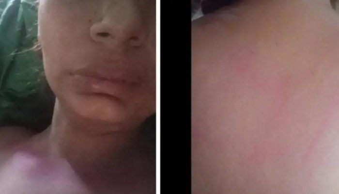 Mulher salta de carro em movimento para escapar de estupro em Ilhéus