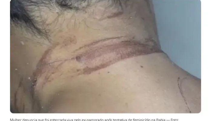 Mulher sobrevive após ser enterrada viva por ex-namorado em Itabuna