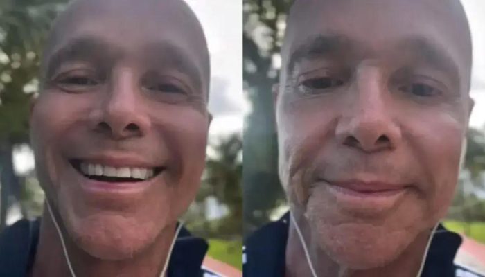 Netinho compartilha superação e mudanças após quimioterapia: cabelo é o próximo