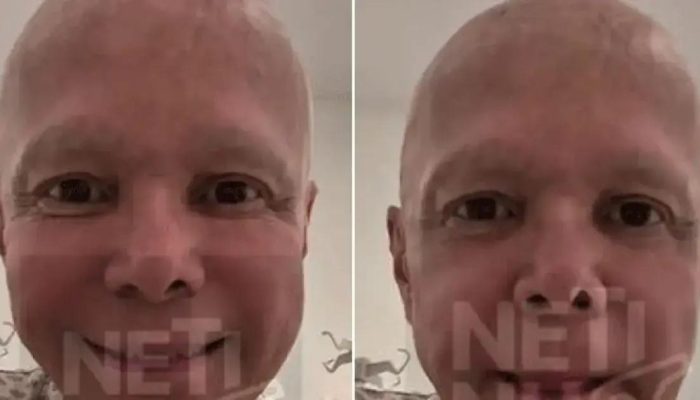 Netinho está na reta final do tratamento de câncer após anunciar cura