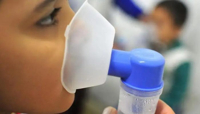 Queda de Casos de SRAG no Brasil: Relatório da Fiocruz Aponta Melhoras