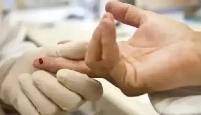 Sesab desmente surto de HIV entre adolescentes na Bahia com dados oficiais