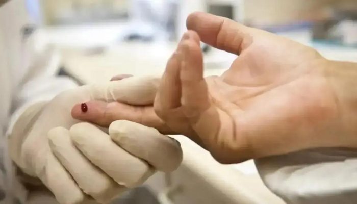 Sesab nega surto de HIV entre jovens na Bahia e esclarece dados